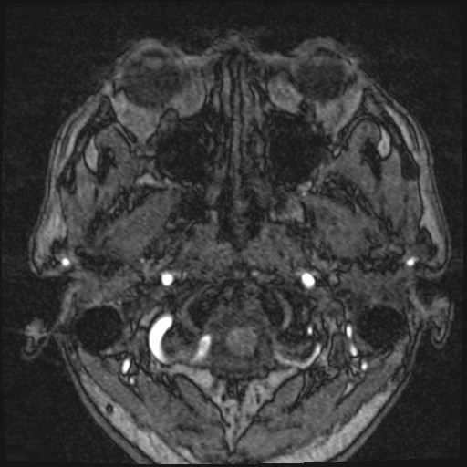 Click on the Serie image to view the images of VILLANUEVA, WILLIAM A.